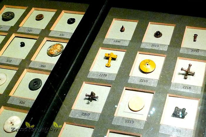 اشیای خارج شده از بدن انسان در موزه ماتر