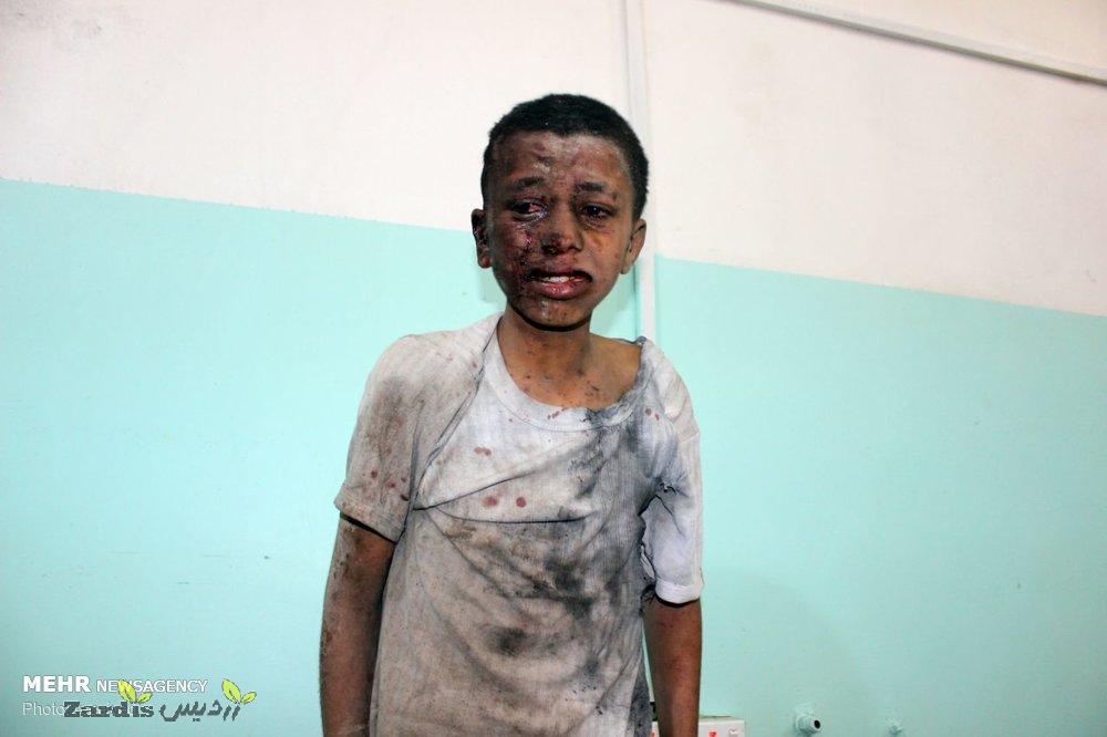 حمله توپخانه ای ائتلاف سعودی به صعده یمن/ ۷ تن کشته و زخمی شدند_thumbnail